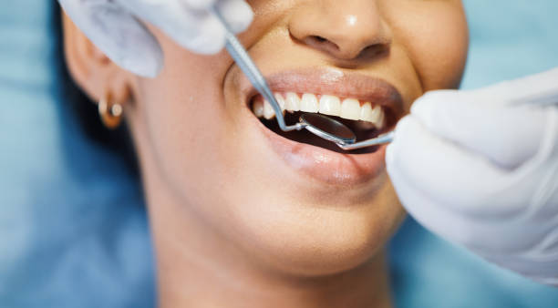 Best Emergency Treatment for Dental Infections or Abscesses in Westwood, KS